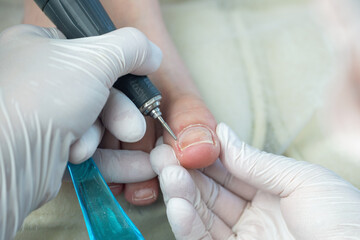 Obraz premium Professional hardware pedicurist, podiatrist cleaning nails using a nail miller