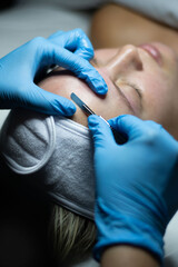 woman getting facial with dermaplaning