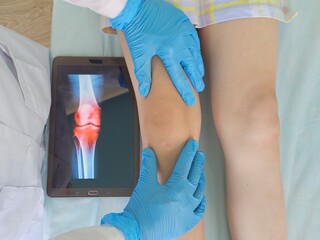 A patient receives a knee examination by a healthcare professional while a digital display shows an image of the knee joint concept
