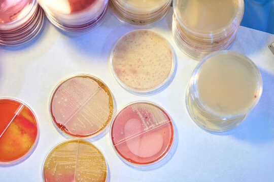 Bacteriological Analysis for Food Safety in Hospitality Industry