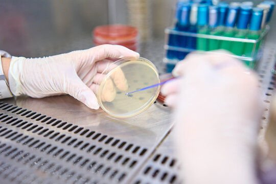 Bacteriologic Laboratory Services for Food and Water Analysis