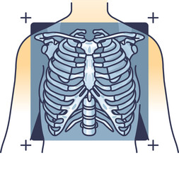 Illustration of a ribcage X-ray, highlighting the skeletal structure of the chest.