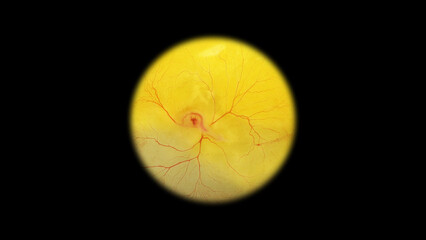 Chicken embryo under a microscope, on the second day of development. Visible blood vessels.