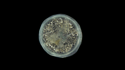 Coral larva under a microscope, order Actiniaria, phylum Cnidaria, adult stage, will soon sink to...