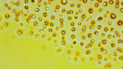Formed crystals of an alcoholic solution of iodine used as a disinfectant, under a microscope.