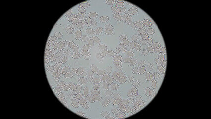 Frog blood under a microscope. Red blood cells have an oval shape and a nucleus, and are also...