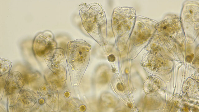 Infusoria Vorticella under the microscope, class Oligohymenophorea. They lead an immobile lifestyle, attaching themselves to immovable objects with the help of a long stalk. Lake Baikal