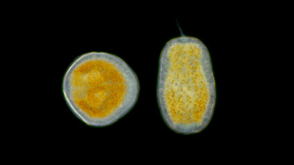 Coral larva Anthozoa class, stage planula under a microscope, adult corals release free-floating larvae for the next generation to breed, they swim with cilia, at the end it burrows into the ground © shoma81