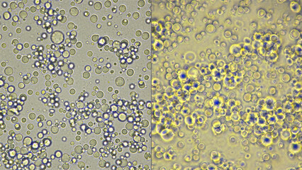 Milk under a microscope, fresh, natural, the movement of useful elements is visible: fats, trace elements and bacteria, filmed by in light and dark field