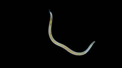Worm Nematoda under microscope, Phylum Protostomia, free-living nematodes inhabit soil, freshwater...