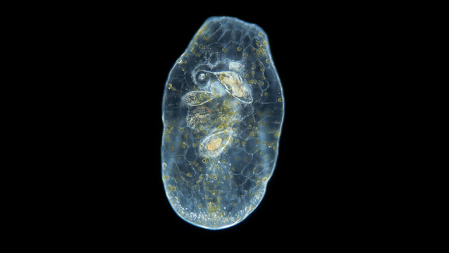 Worm Acoela under a microscope, class Turbellaria. One can see the statocyst: organ of balance and the perchyma, where food is digested. Indian Ocean