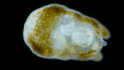 Worm Turbellaria, order Acoela under a microscope. In symbiosis with Zooxanthellae algae, which...
