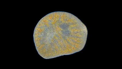 Worm order Polycladida under a microscope, possibly Leptoplana sp. The specimen was found in the White Sea.