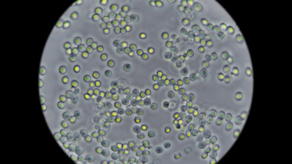 Yeast under the microscope, used for baking bread.