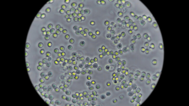 Yeast under the microscope, used for baking bread.