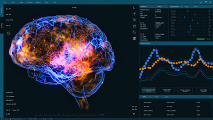 3D VFX Animation of a Brain Scan in Medical Software, Visualization of Neural Activity and Data Visualization. Screen Replacement for Medical Hospitals and Software Engineers in Brain Research Science