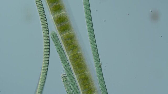 blaualgen bewegen sich im s&uuml;&szlig;wasser, mikroskop film, cyanobacteria