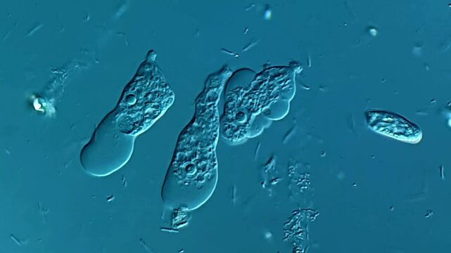Amoeba under DIC microscope (40x Objective)