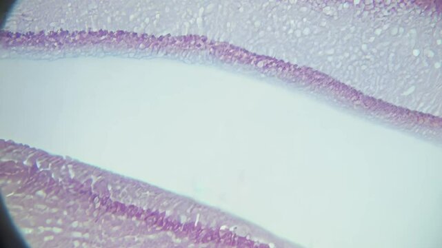 Microscope showing cross section of ascaris lumbricoides