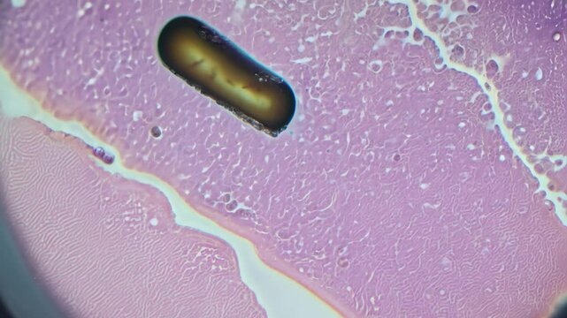 Microscope investigating parasite eggs in blood sample
