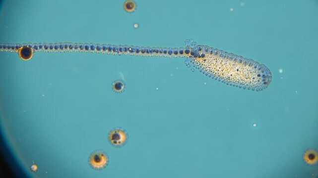 Paramecium aurelia swimming with food vacuoles