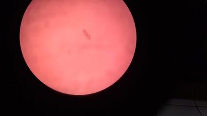 penicillin from the microscope