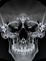 Panoramic X-ray of Human Skull and Teeth