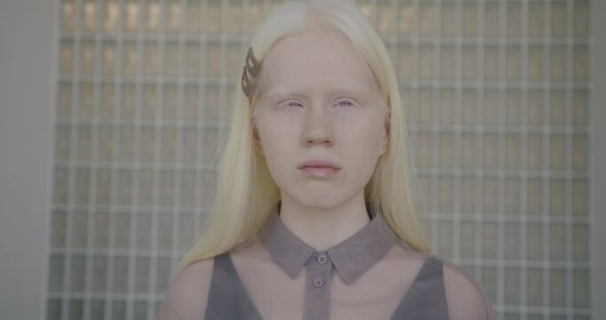 Close-up slow motion portrait of young albino lady against creative studio background looking at camera with calm face. People and individual style concept.