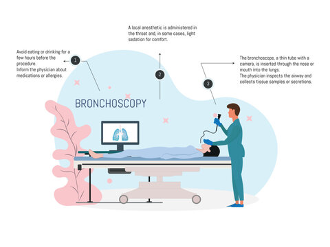 Bronchoscopy procedure.Medical illustration showing the process of a bronchoscopy, including the insertion of the bronchoscope.