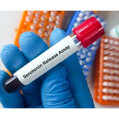 Blood sample for Heparin Induced Thrombocytopenia (HIT) PF4 Antibody, IgG with Reflex to Serotonin...