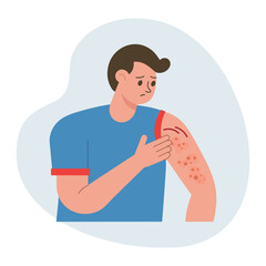 Man scratching his hand. Allergic itching, skin inflammation, redness and irritation. Atopic dermatitis, eczema, psoriasis. Healthcare and medicine.