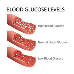 Blood Sugar Level Ranges