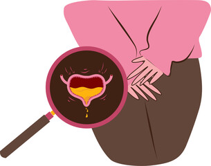 Bladder disease illustration. Urinary tract infection. Bladder cancer. Bladder stones. Bladder inconvenience.