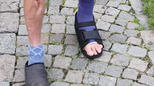 man walks along a rocky path with a broken leg in a purple fibreglass cast, his foot shod in a special walking sandal,concept of an active lifestyle,