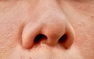 Close up human nose with oily skin and blackheads comedo on pores isolated on horizontal ratio bare face texture background.