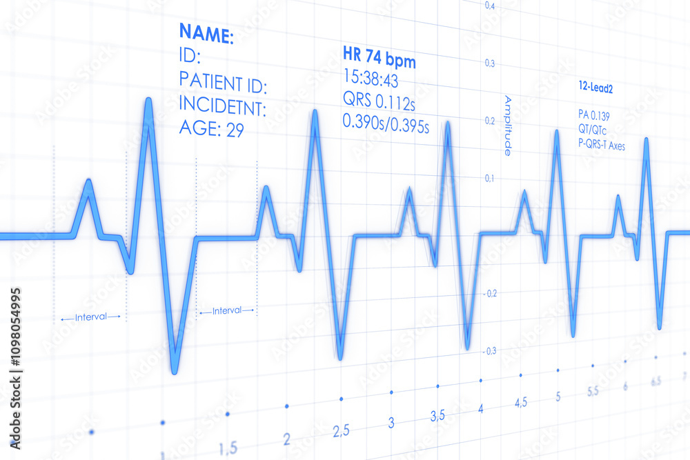 Aufkleber Blue ECG signal graph with patient data on white grid background, clean layout, representing medical monitoring and heart health. 3D Rendering.