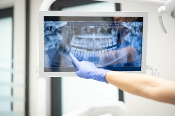 A close-up image capturing a dentist's gloved hand pointing to a dental X-ray on a screen, focusing...