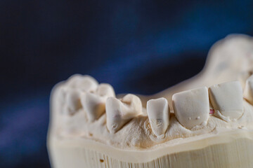 Object image of a dental impression