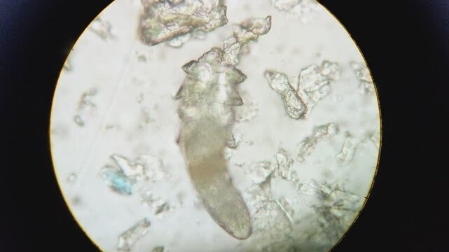 Footage of viable Demodex or face mites seen moving under the microscope