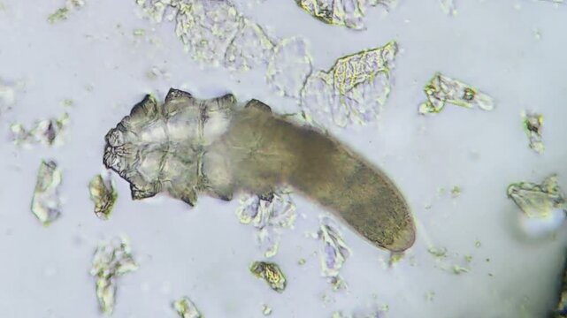 Footage of viable Demodex or face mites seen moving under the microscope, on white surface