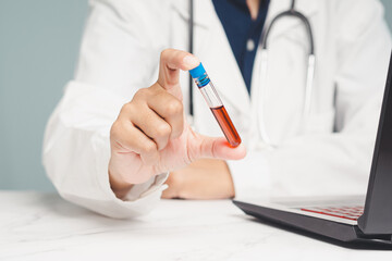 Doctor holding test tube with blood sample, healthcare and medical diagnostics concept.