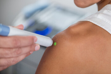 A physical therapist performs laser therapy on a patients shoulder to reduce pain, decrease...