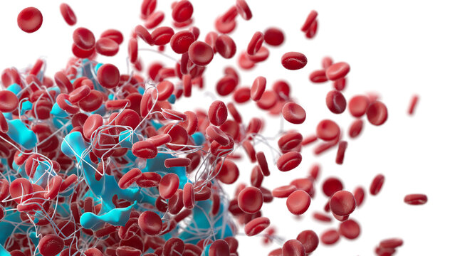 Blood clot, illustration