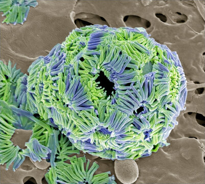 Coccolithophore, SEM