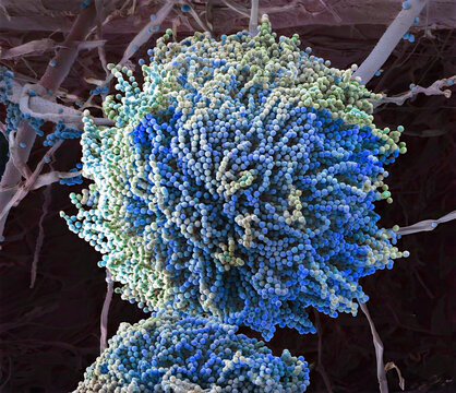 Aspergillus fungus, SEM