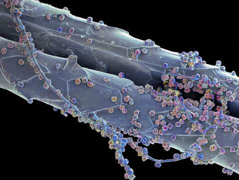 Fungal spores on hair, SEM