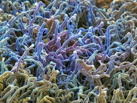 Fungal hyphae, SEM
