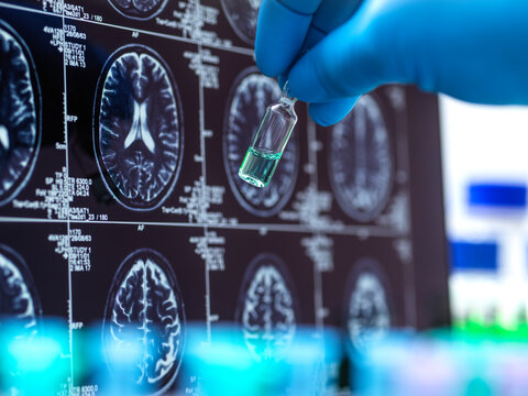 Hand of scientist developing new medicine near MRI scan on screen
