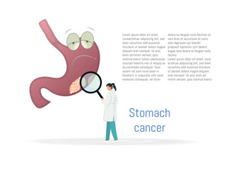 Stomach cancer illustrated graphically.Graphic representation of a stomach affected by cancer with a professional examining the tumors.