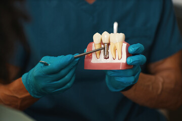 Dentist wearing blue scrubs and gloves explaining dental implant process using a plastic model of...